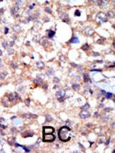 c-Abl Antibody in Immunohistochemistry (Paraffin) (IHC (P))