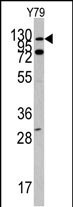 c-Abl Antibody in Western Blot (WB)