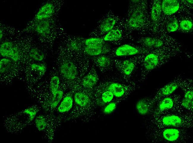 RSK2 Antibody in Immunocytochemistry (ICC/IF)