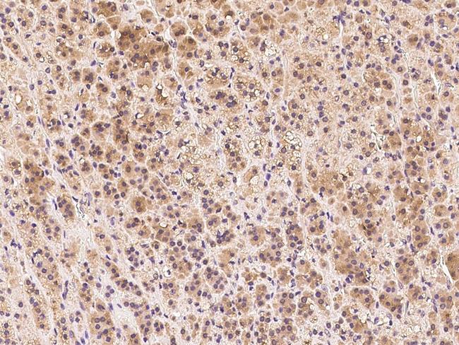 Clathrin Heavy Chain Antibody in Immunohistochemistry (Paraffin) (IHC (P))