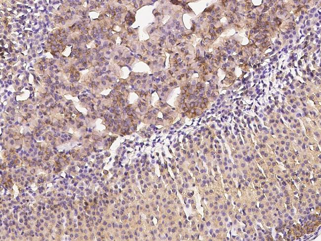 Clathrin Heavy Chain Antibody in Immunohistochemistry (Paraffin) (IHC (P))