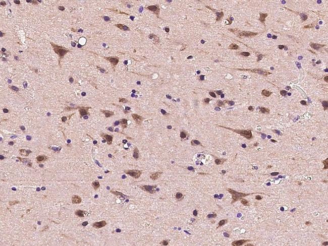 PSMC2 Antibody in Immunohistochemistry (Paraffin) (IHC (P))