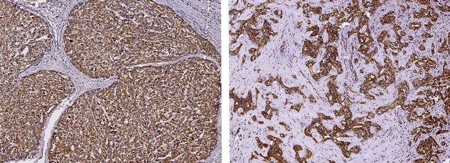 PPCDC Antibody in Immunohistochemistry (Paraffin) (IHC (P))