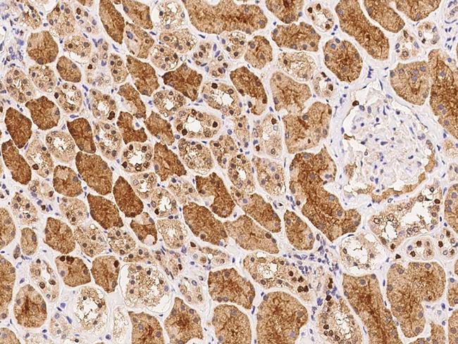 SCLY Antibody in Immunohistochemistry (Paraffin) (IHC (P))