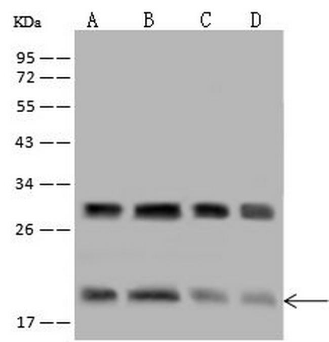 eIF5A2 Antibody in Western Blot (WB)