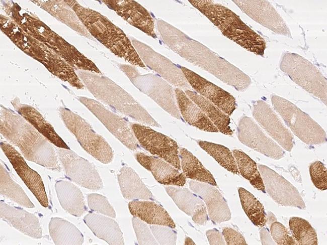 PAR6 Antibody in Immunohistochemistry (Paraffin) (IHC (P))