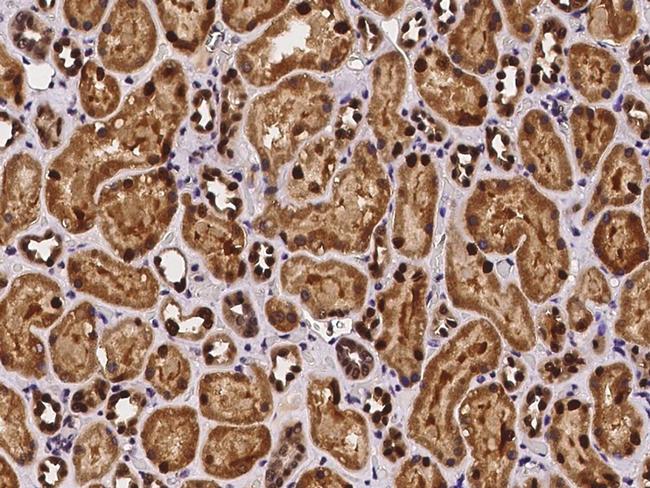 SCLY Antibody in Immunohistochemistry (Paraffin) (IHC (P))