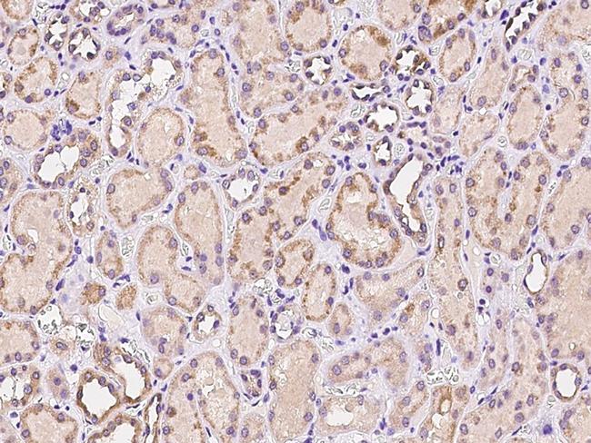 CTR2 Antibody in Immunohistochemistry (Paraffin) (IHC (P))