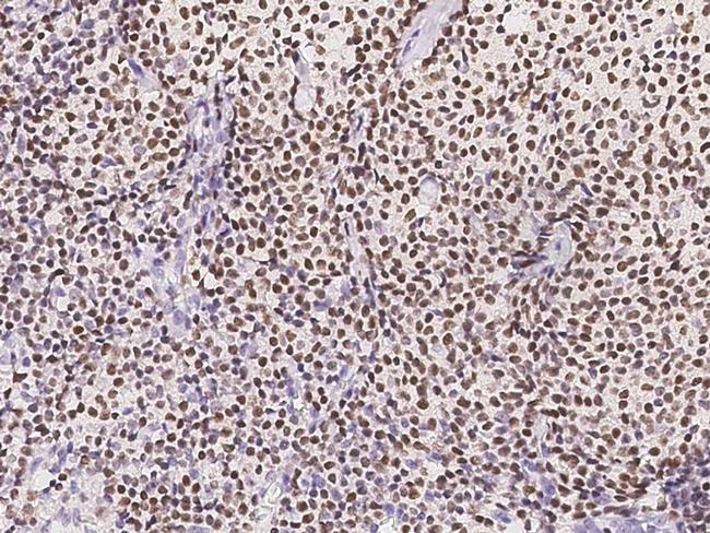 RUNX3 Antibody in Immunohistochemistry (Paraffin) (IHC (P))