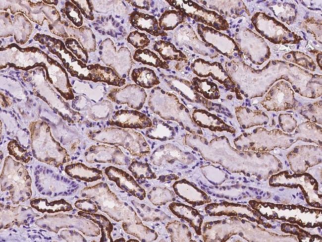 CRP2 Antibody in Immunohistochemistry (Paraffin) (IHC (P))