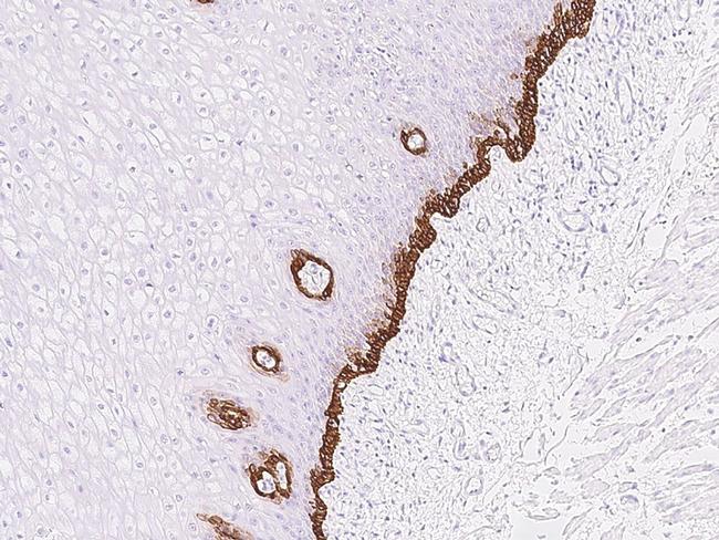 RAC3 Antibody in Immunohistochemistry (Paraffin) (IHC (P))