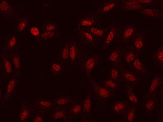 HSD17B6 Antibody in Immunocytochemistry (ICC/IF)