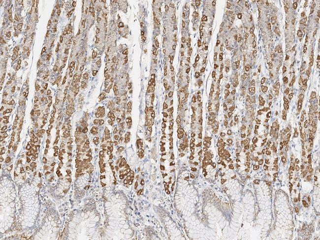 MTCO2 Antibody in Immunohistochemistry (Paraffin) (IHC (P))