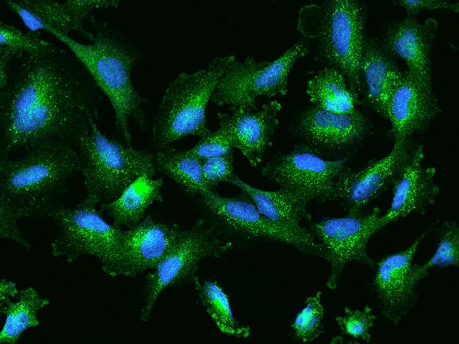 SLC26A2 Antibody in Immunocytochemistry (ICC/IF)