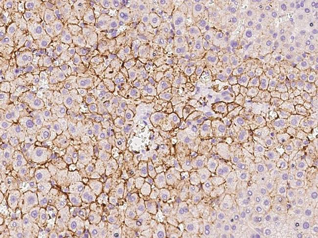 OATP8 Antibody in Immunohistochemistry (Paraffin) (IHC (P))