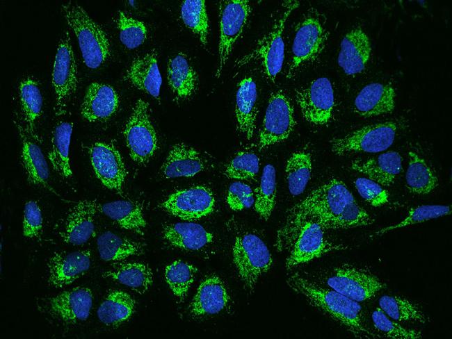 TIMM17B Antibody in Immunocytochemistry (ICC/IF)