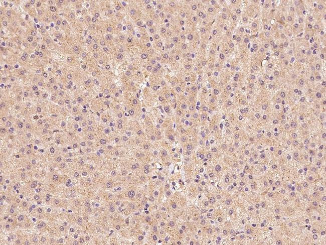 ZADH2 Antibody in Immunohistochemistry (Paraffin) (IHC (P))