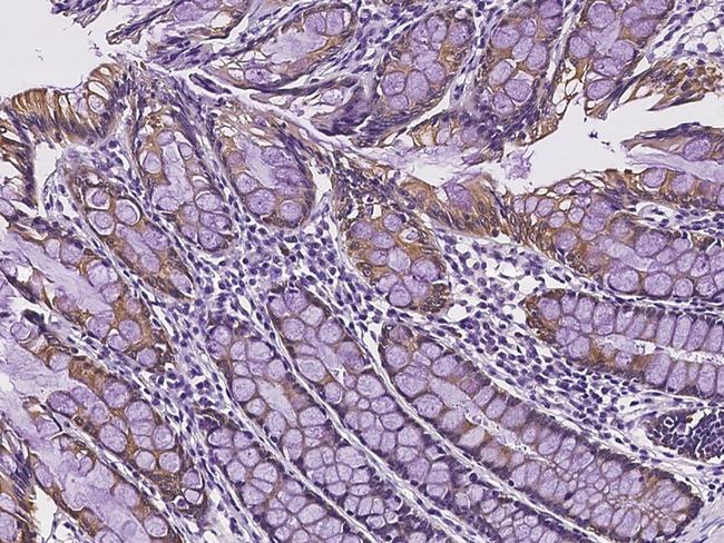 SLC35A2 Antibody in Immunohistochemistry (Paraffin) (IHC (P))