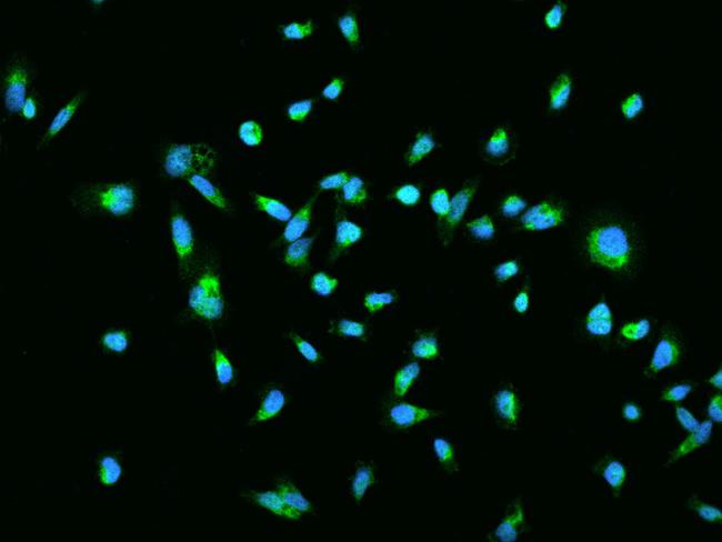 TRIAP1 Antibody in Immunocytochemistry (ICC/IF)