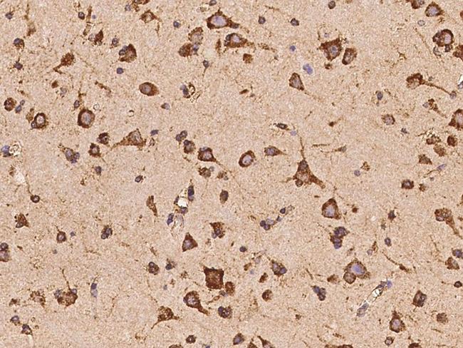 OARD1 Antibody in Immunohistochemistry (Paraffin) (IHC (P))