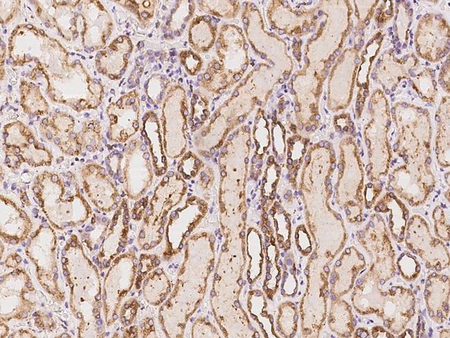 DNAH8 Antibody in Immunohistochemistry (Paraffin) (IHC (P))