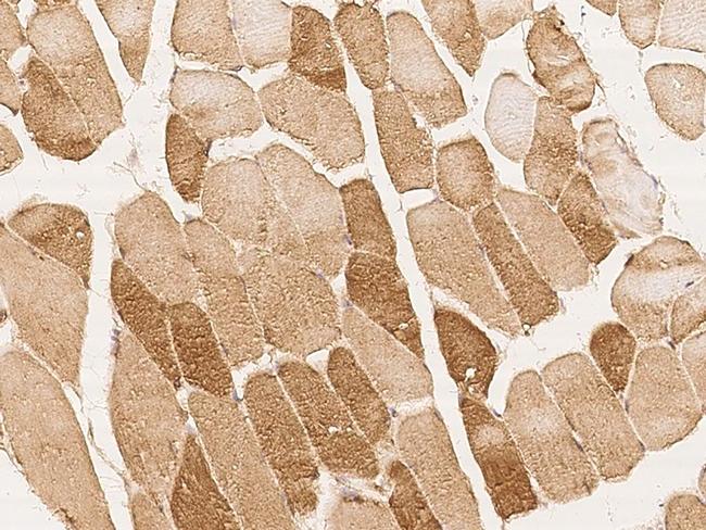 MLK2 Antibody in Immunohistochemistry (Paraffin) (IHC (P))