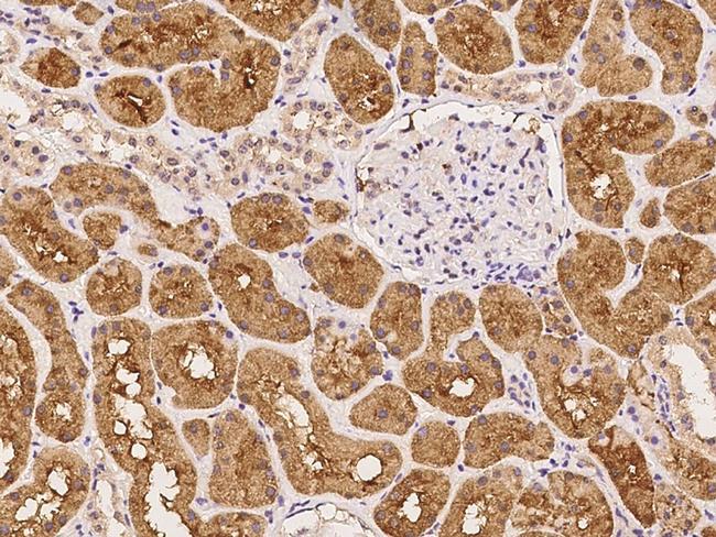 ARHGAP21 Antibody in Immunohistochemistry (Paraffin) (IHC (P))