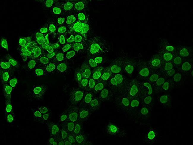 AHCTF1 Antibody in Immunocytochemistry (ICC/IF)