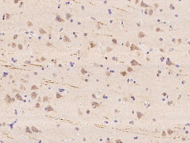 WBSCR17 Antibody in Immunohistochemistry (Paraffin) (IHC (P))