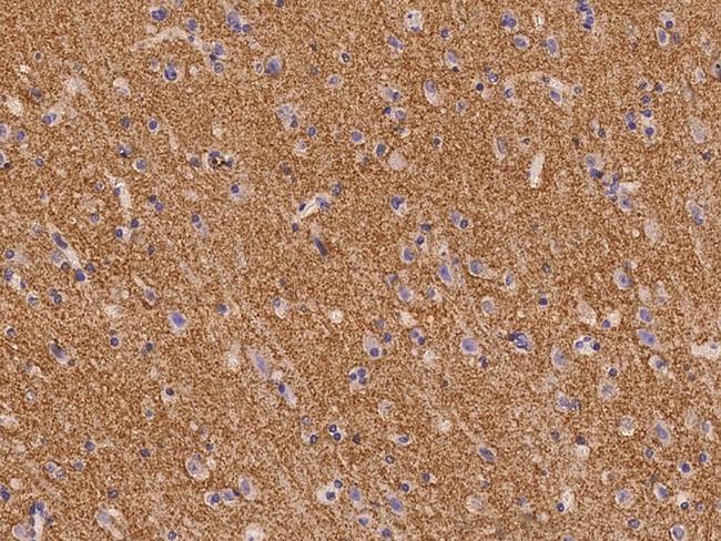 SV2B Antibody in Immunohistochemistry (Paraffin) (IHC (P))