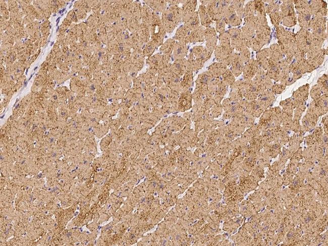 ATP13A3 Antibody in Immunohistochemistry (Paraffin) (IHC (P))