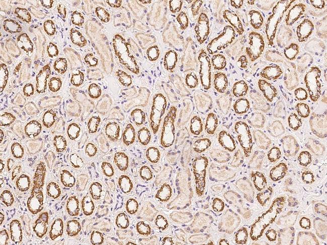 SLX1A Antibody in Immunohistochemistry (Paraffin) (IHC (P))