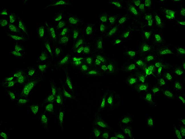 CREBRF Antibody in Immunocytochemistry (ICC/IF)