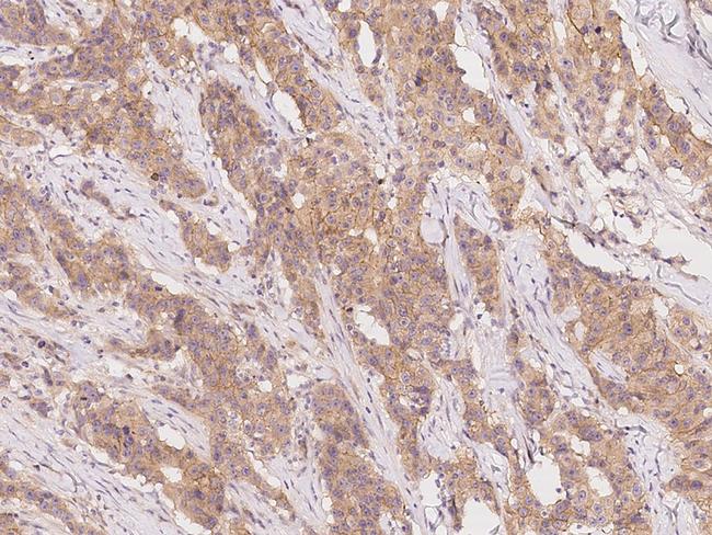 SLC44A1 Antibody in Immunohistochemistry (Paraffin) (IHC (P))