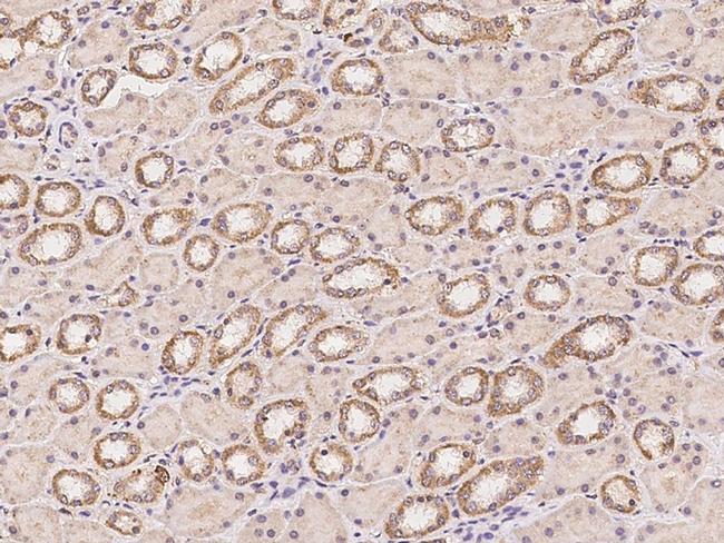 MLK3 Antibody in Immunohistochemistry (Paraffin) (IHC (P))