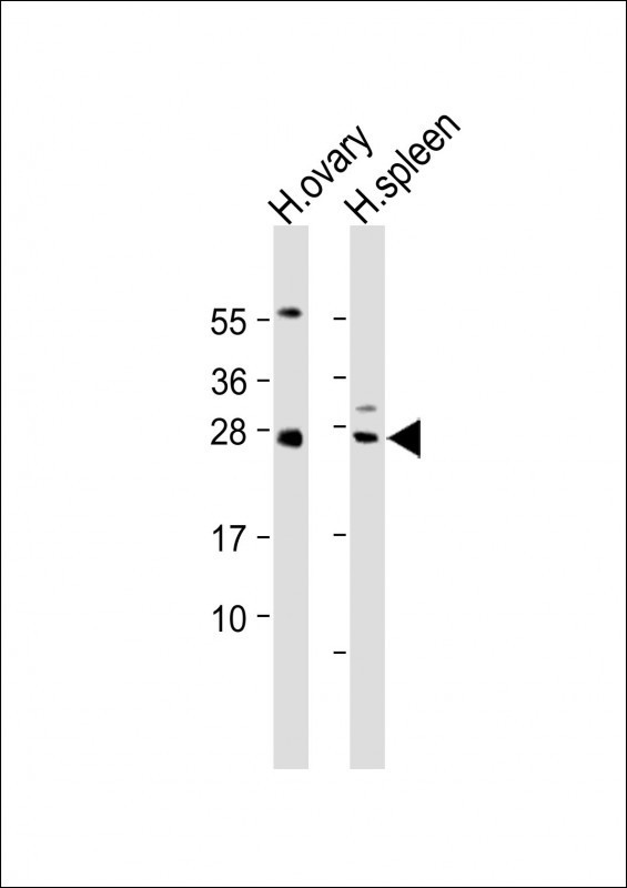 NTF3 Antibody in Western Blot (WB)