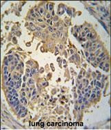 RIP3 Antibody in Immunohistochemistry (Paraffin) (IHC (P))