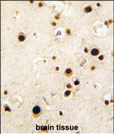 HnRNP Q Antibody in Immunohistochemistry (Paraffin) (IHC (P))