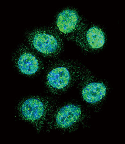 ALOX15 Antibody in Immunocytochemistry (ICC/IF)