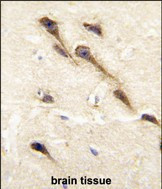 CYP26B1 Antibody in Immunohistochemistry (Paraffin) (IHC (P))