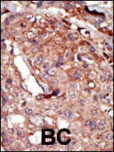 BRD2 Antibody in Immunohistochemistry (Paraffin) (IHC (P))