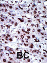 Adenylate Kinase 5 Antibody in Immunohistochemistry (Paraffin) (IHC (P))