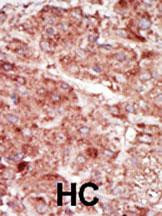 HK3 Antibody in Immunohistochemistry (Paraffin) (IHC (P))