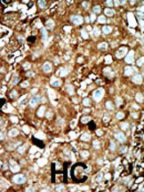 PFKFB3 Antibody in Immunohistochemistry (Paraffin) (IHC (P))