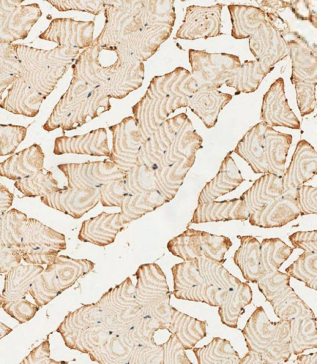 PFKFB4 Antibody in Immunohistochemistry (Paraffin) (IHC (P))