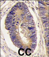 PTPN3 Antibody in Immunohistochemistry (Paraffin) (IHC (P))