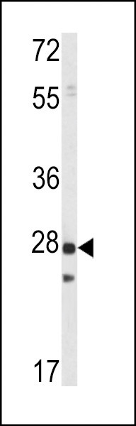 PRL1 Antibody in Western Blot (WB)