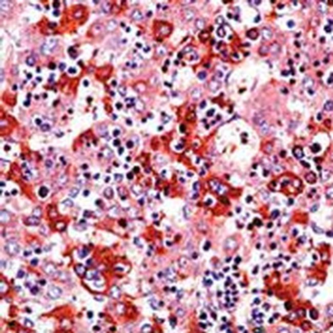 AFP Antibody in Immunohistochemistry (Paraffin) (IHC (P))