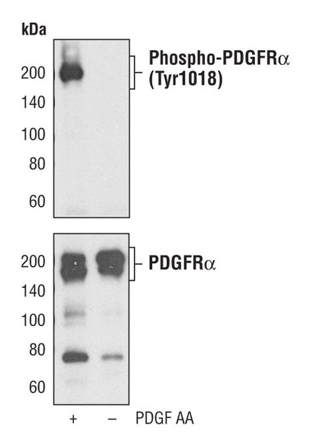 Phospho-PDGFRA (Tyr1018) Antibody in Western Blot (WB)