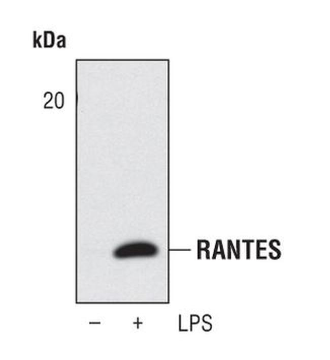 CCL5 (RANTES) Antibody in Western Blot (WB)